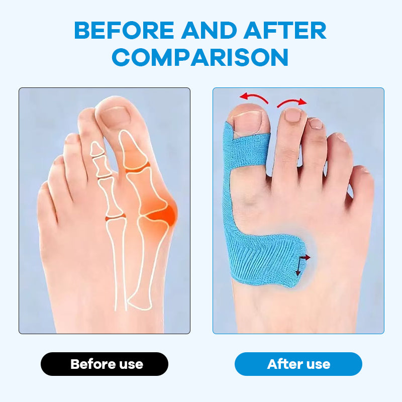 Bunion Relief Toe Correction Wrap