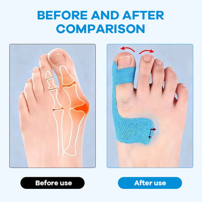 Bunion Relief Toe Correction Wrap