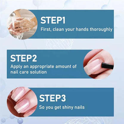 🔥Final 4 Hours 50% OFF💕3 Days Nail Care Formula