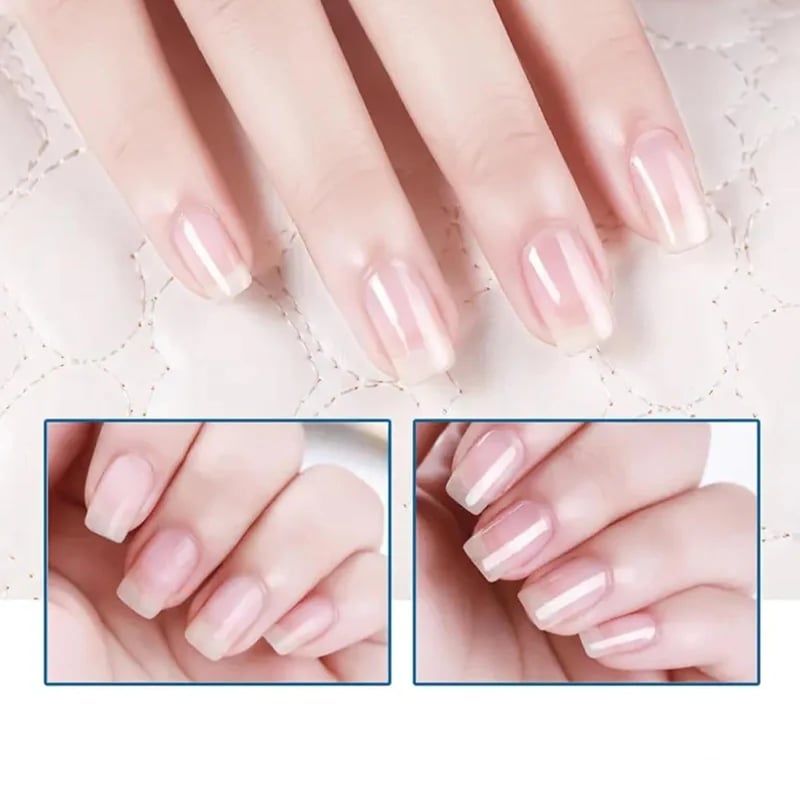 🔥Final 4 Hours 50% OFF💕3 Days Nail Care Formula